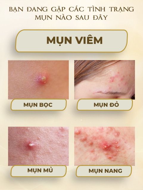 mun-viem