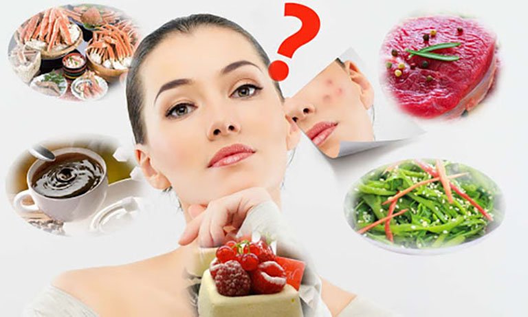 Giải đáp câu hỏi: Da mụn không nên ăn gì? 1 Da mụn không nên ăn gì?