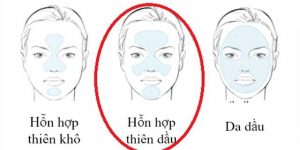 Da hỗn hợp là gì? Đây là loại da phổ biến nhưng lại thuộc tuýp khó chăm sóc