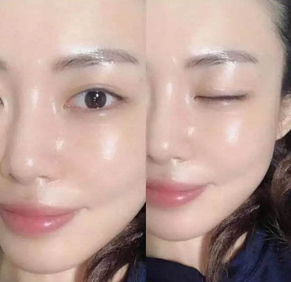 Da mụn có nên dùng retinol không là câu hỏi của rất nhiều người đang bị mụn