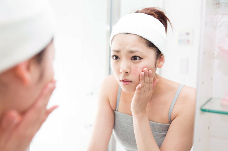 Những điều cần lưu ý khi lựa chọn mỹ phẩm trị mụn cho tuổi dậy thì 8 Những mỹ phẩm dành cho tuổi dậy thì khi bị mụn